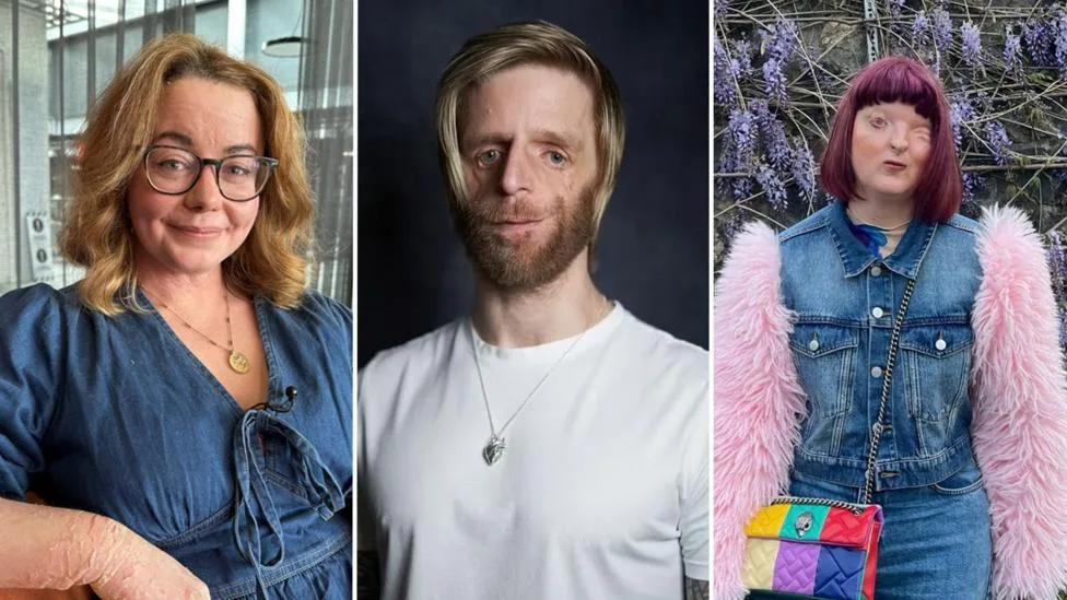 Image accompanying reporting about We love how we look but AI tried to 'fix' our visible differences